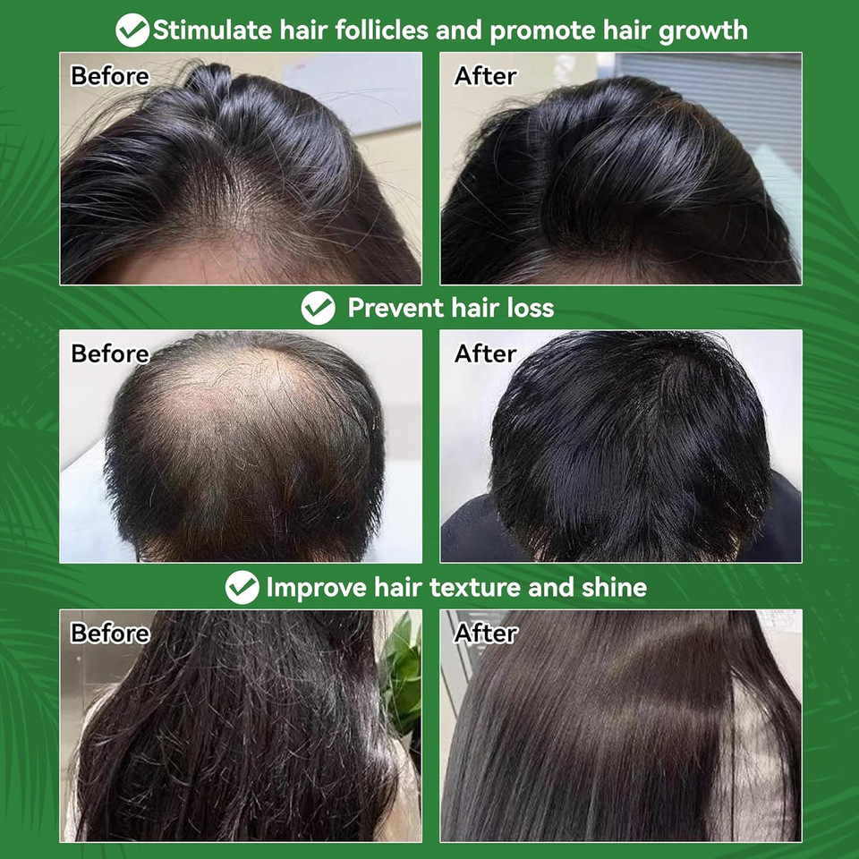 Dr. Sebi Batana Oil for Hair Growth - 100% Organic, Repairs Damaged Hair, Prevents Loss & Enhances Thickness - 4.05 OZ