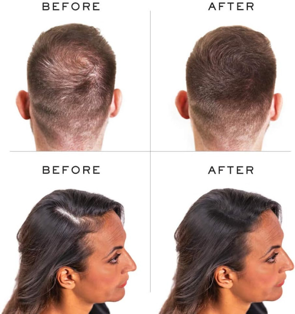 Nanogen Instant Thickening Hair Fibres Light Brown 30g- Natural Keratin fibers cover thinning hair and hair loss, extensions, alopecia, thicker, fuller hair instantly