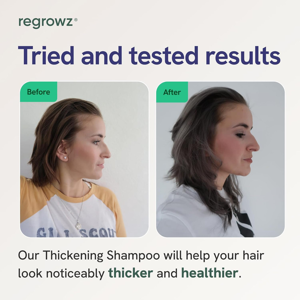 Regrowz Miracle Hair Thickening Shampoo  2x 225ml  Organic Biotin & Rosemary Oil natural Hair Loss Treatment for Men & Women- rosemary shampoo for hair growth- DHT blocker shampoo