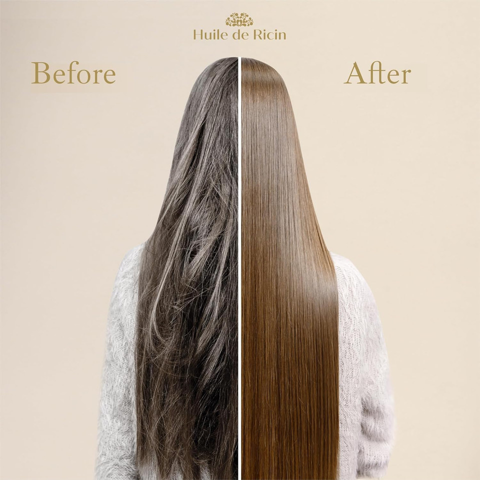 Arganicare | Duo Shampoo + Conditioner | Castor | Growth Accelerator | Gently Cleans & Moisturizes Hair | All hair types | 1x400 ML+ 1x400mL