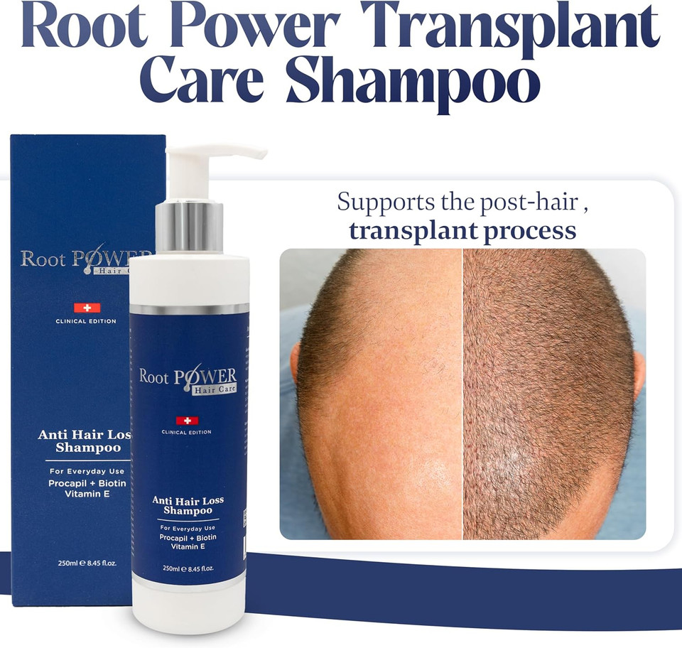 Anti Hair Loss Shampoo for Everyday Use  Enriched with Procapil, Biotin & Vitamin E  Supports Stronger, Fuller Hair  Ideal for After Hair Transplant & Post-Operation Care