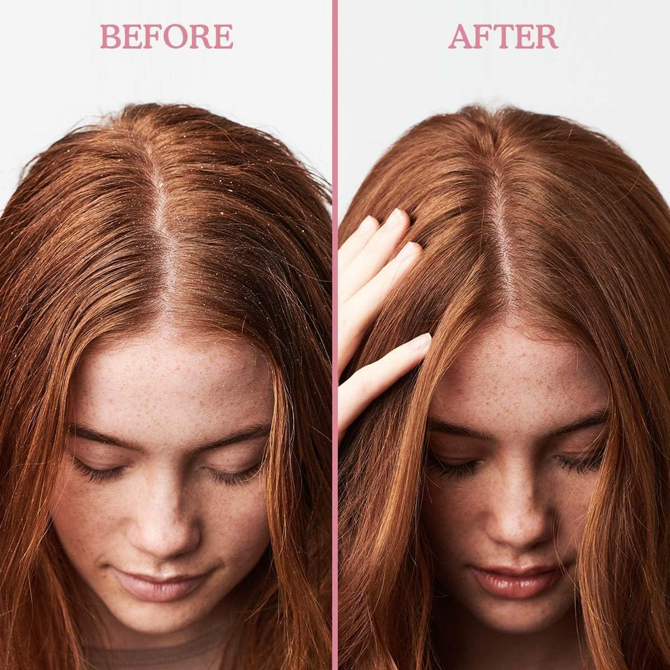 Umberto Giannini Scalp Restore Balancing Conditioner, Vegan & Cruelty Free Scalp Reviving Formula with Coconut Oil & Vitamin E, 250ml