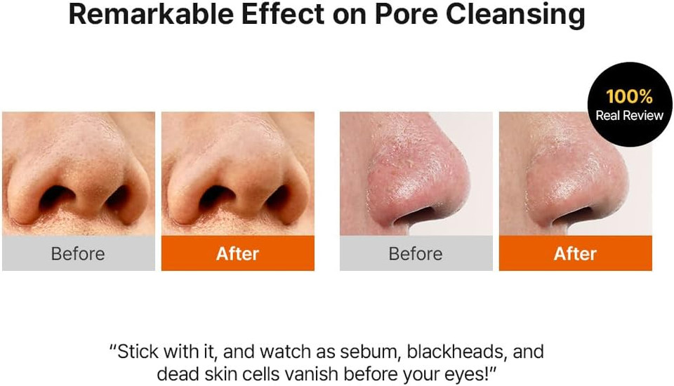 Hanskin Pore Cleansing Oil, Gentle Blackhead Cleanser and Makeup Remover for Sensitive Skin [PHA] (300 ml)