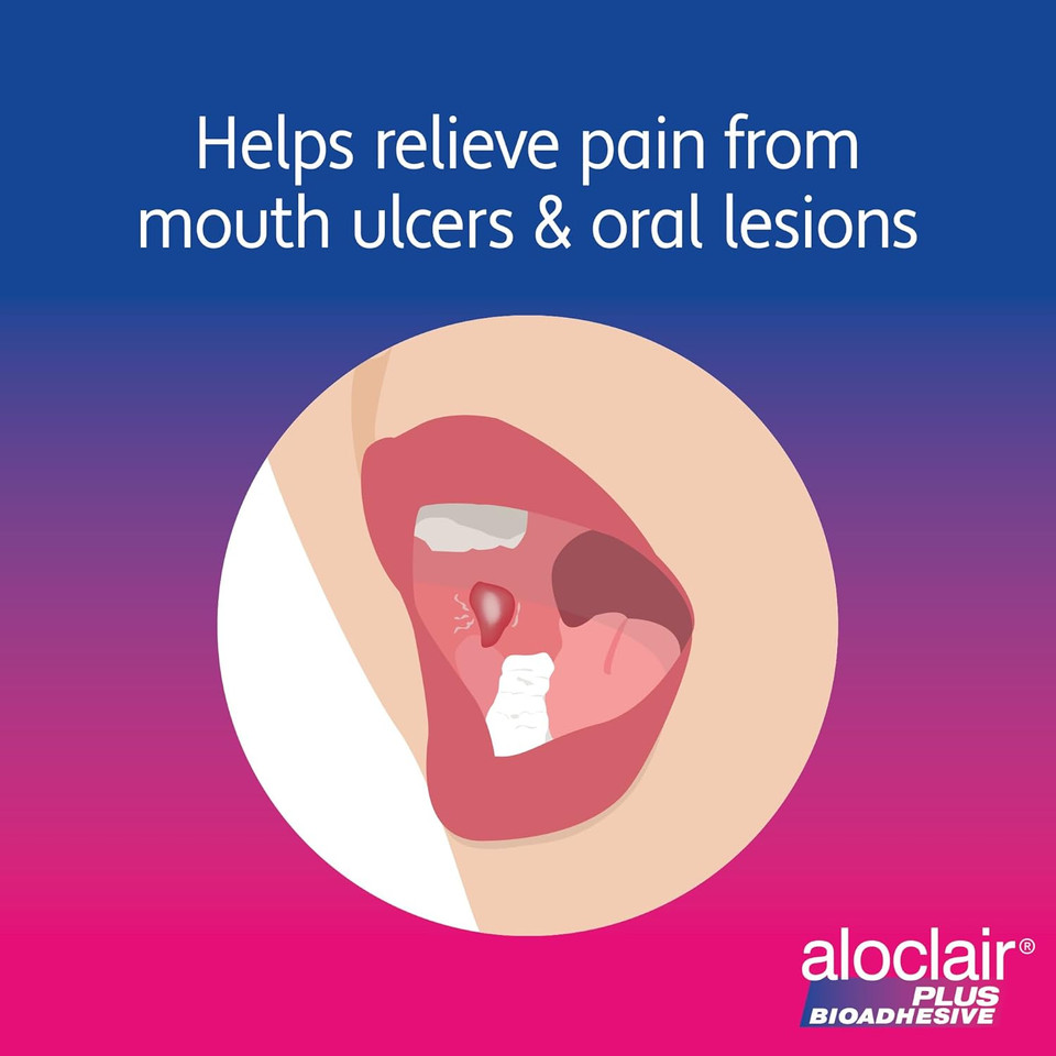 Aloclair Plus Bioadhesive Mouth Ulcer Treatment Mouthwash 120ml. Long lasting protection, up to10-Hour Protection, Soothes Mouth Ulcers & Oral Lesions, for Adults & Children 4 Years +