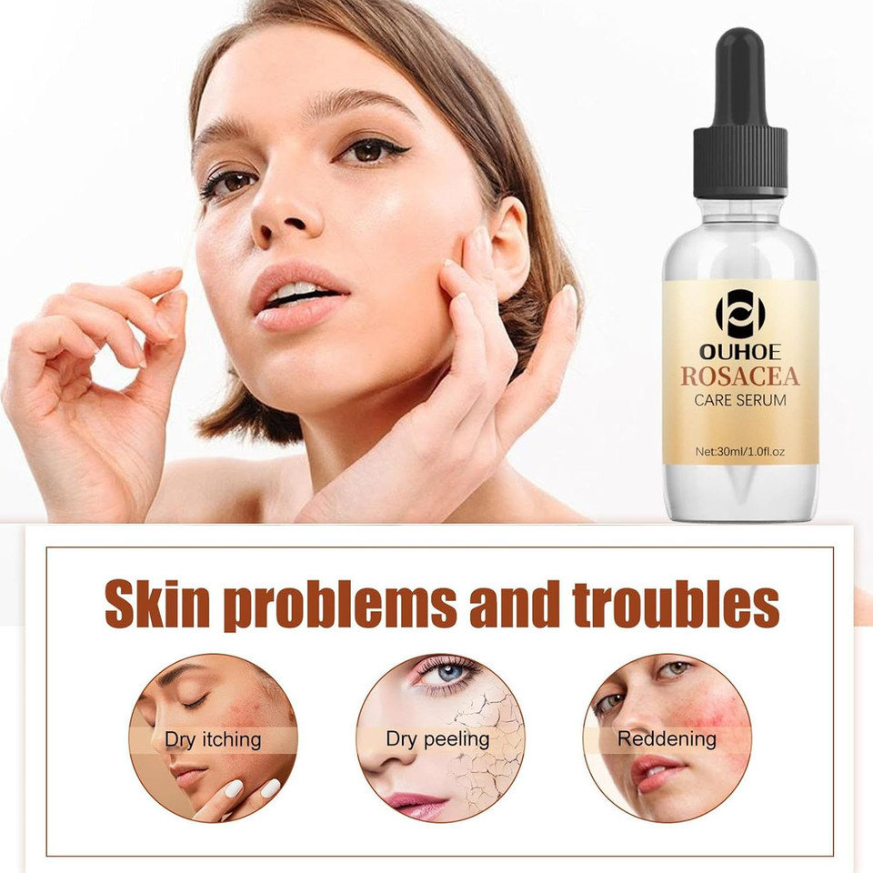 Redness Relief for Face, Rosacea Repair Secrums, Redness Reducing Treat, Moisturizing Facial Serums To Repair Skin Barrier, 1 Fl Oz Bexdug