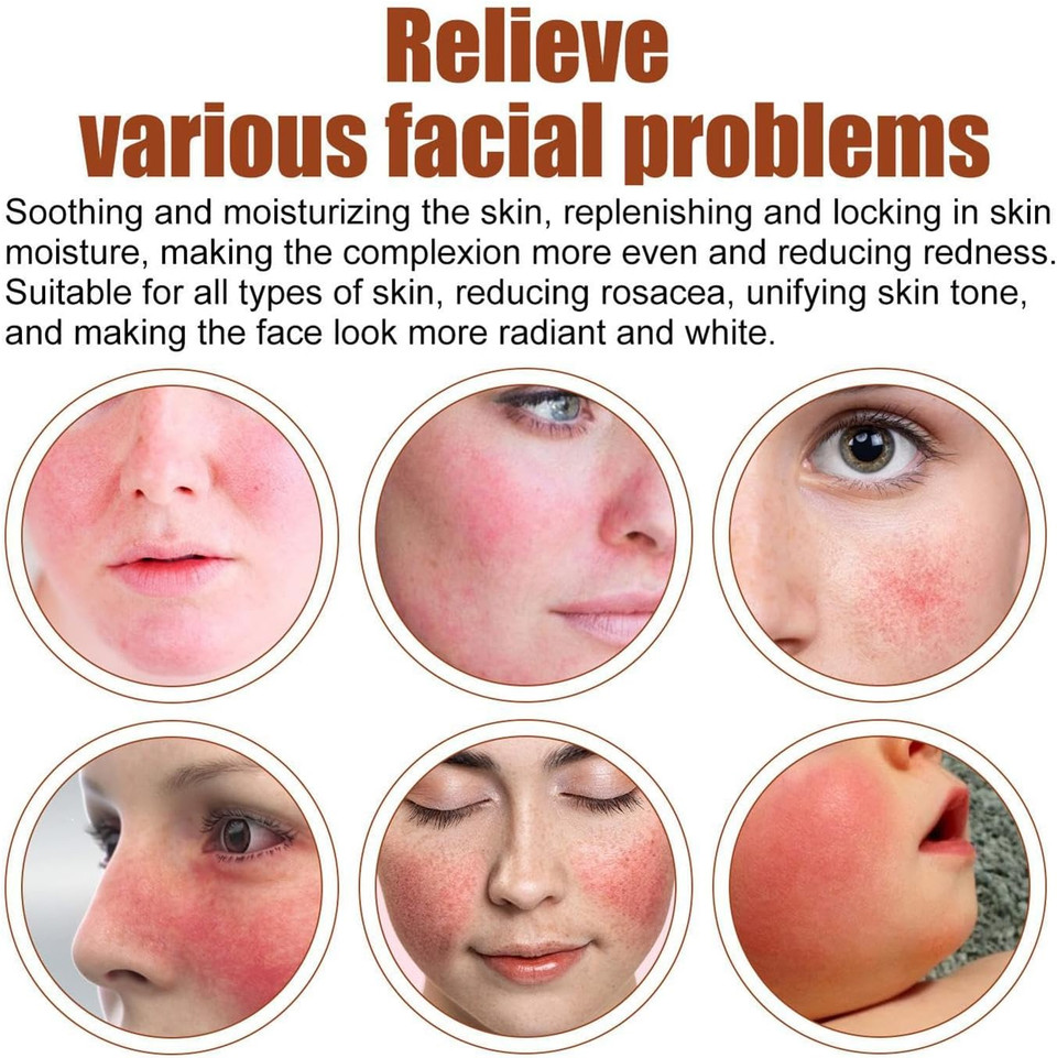 Redness Relief for Face, Rosacea Repair Secrums, Redness Reducing Treat, Moisturizing Facial Serums To Repair Skin Barrier, 1 Fl Oz Bexdug