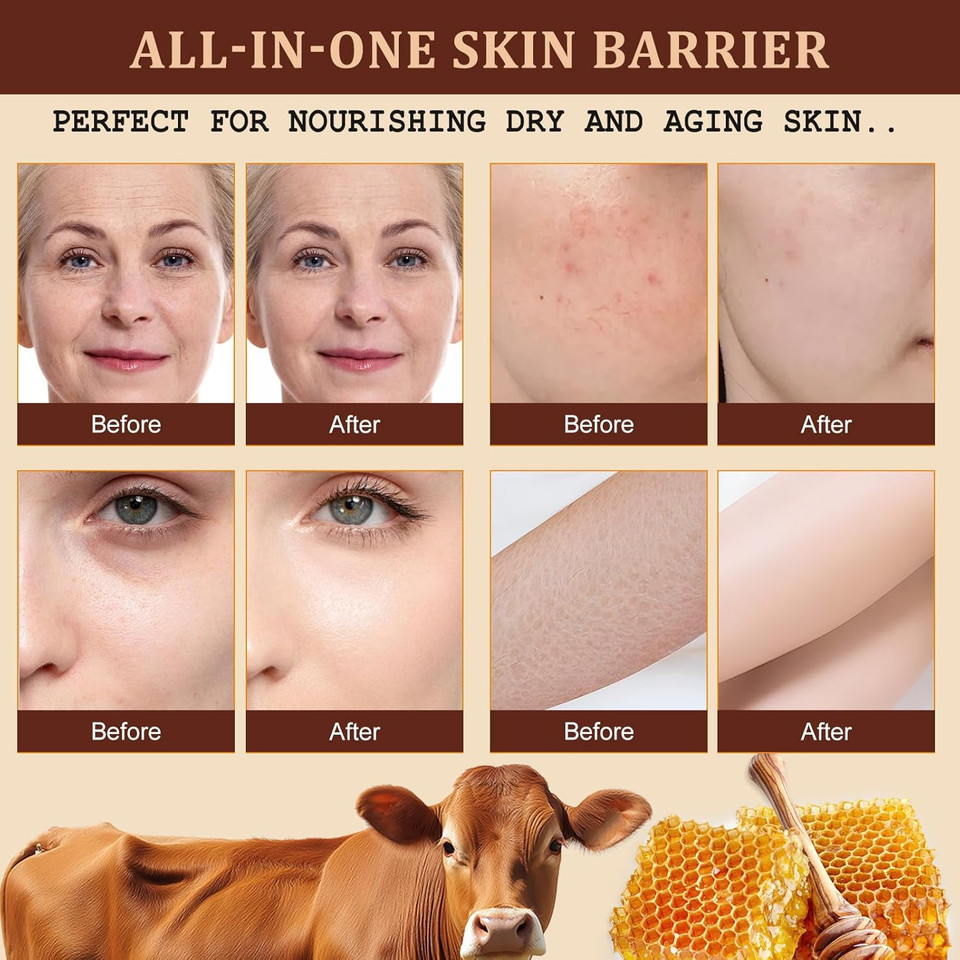 Tallow and Honey Balm (120g), Beef Tallow for Skin, Tallow Face Moisturizer, Organic Grass Fed Whipped Beef Tallow Cream, Deeply Hydrates and Moisturizes Face Body, Fast Absorption, Glass Bottle