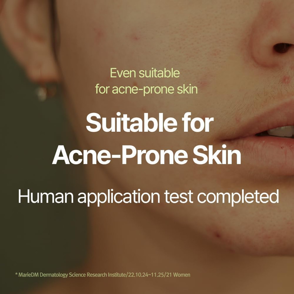 [PKY] Pyunkang Yul Calming Moisture Serum Instantly Soothes Sensitive Skin, Strenghtens Moisture Barrier with Ceramide, 2 types of Peptides, Vegan, Korean skincare. (1.01 Fl.Oz, 30ml)