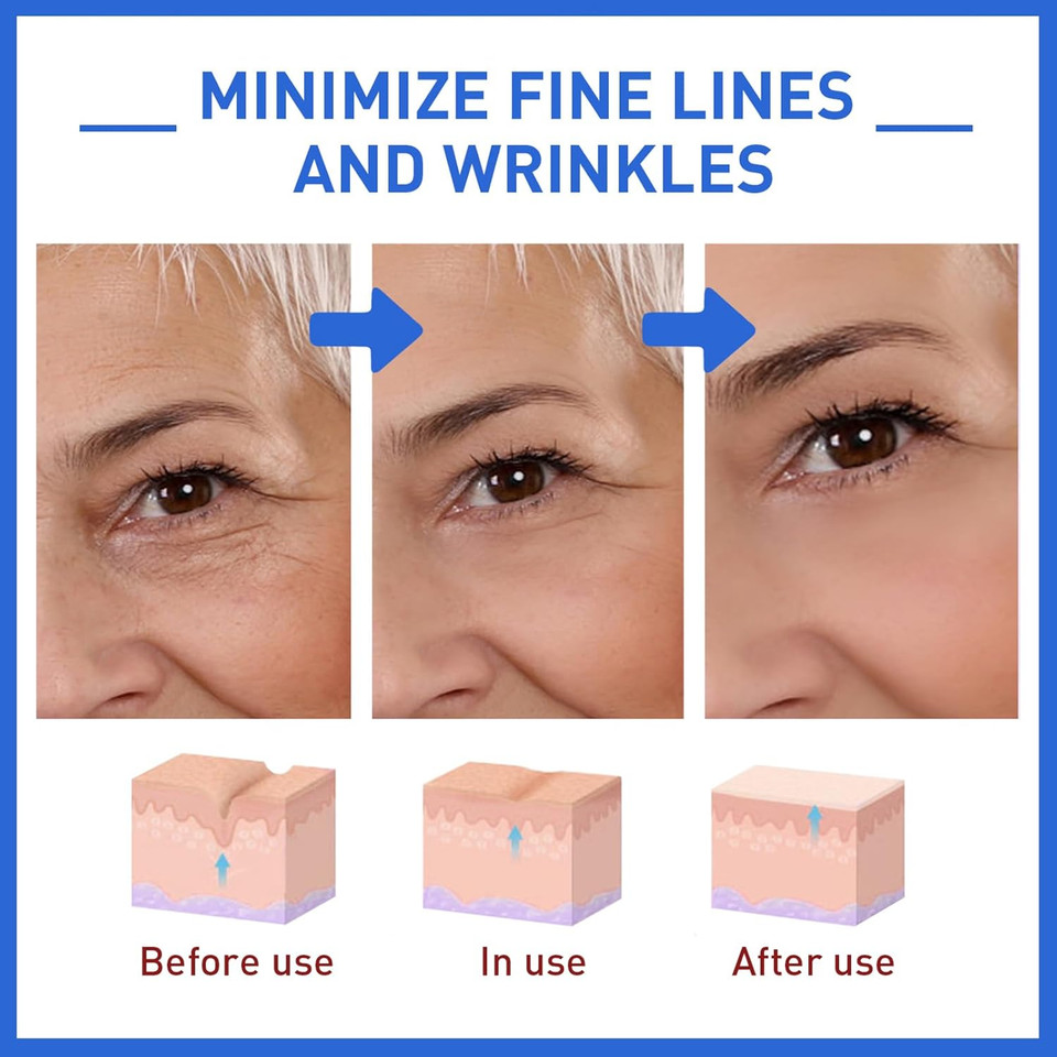 2PCS Boto-x Stock Solution?Boto-x Face Serum UK?Collagen Serum for Face? Boto-x In A Bottle? Boto-x Stock Anti Aging Serum for Face?Reduce Wrinkles, Anti-aging, Boost Skin Collagen(2PCS)