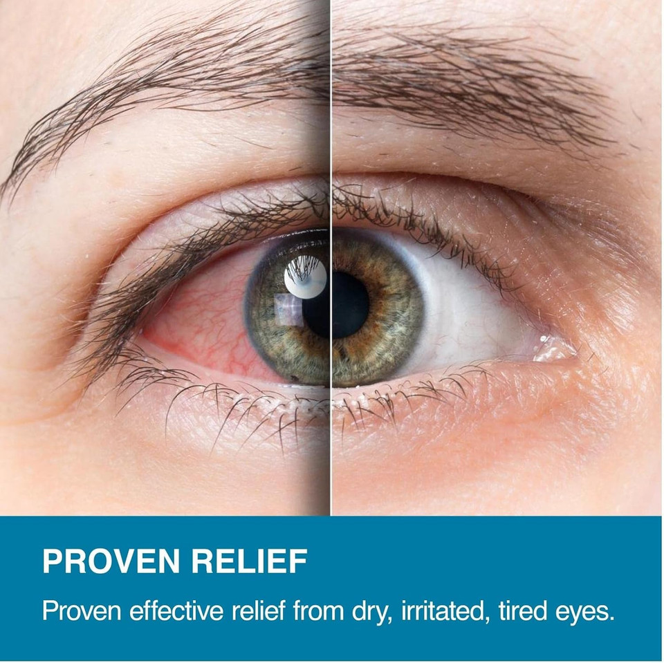 Eye Logic Dry Eye Spray | Fast, Effective Relief for Dry, Irritated Eyes | Easy-to-Use Application | 100+ Sprays | Ideal for Contact Lens Wearers | 10ml