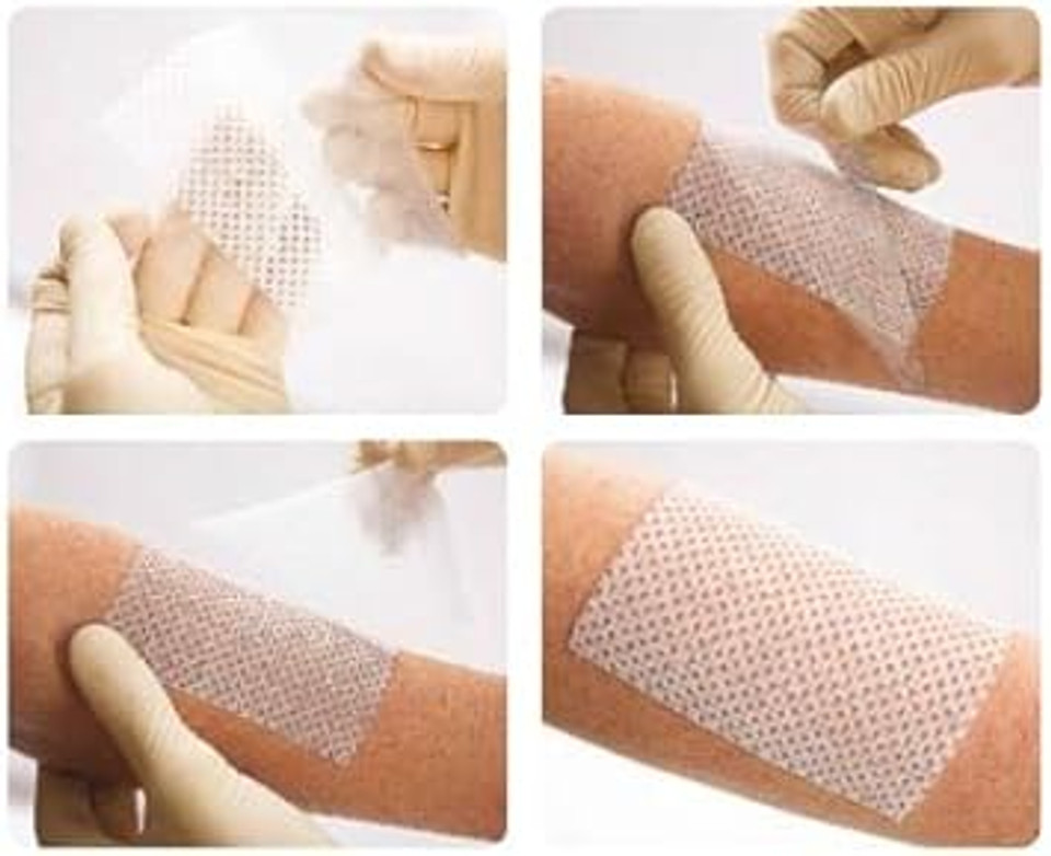 Silflex - Silicone Contact Layer dressing 12cm x 15cm (x10)