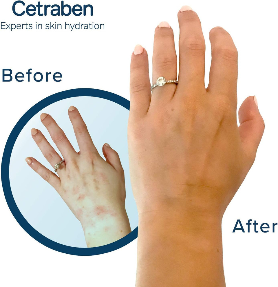 Cetraben 2-in-1 Daily Cleansing Cream and Body Moisturiser Perfect for Dry Sensitive or Eczema Skin 200ml, Unscented, 1 pack