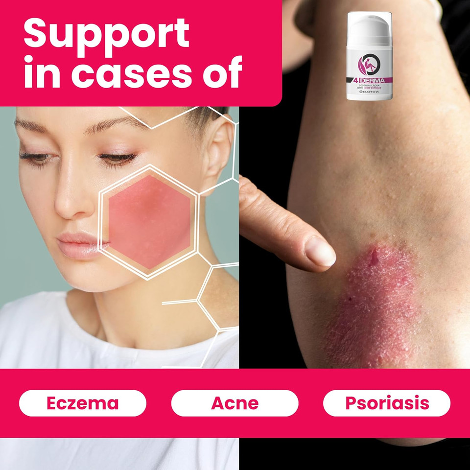 EUSPHERA - 4DERMA - Soothing Cream for Eczema with Hemp Extract - Natural Itch Relief Cream for Psoriasis, Eczema, Dry Skin, Dermatitis 50ml