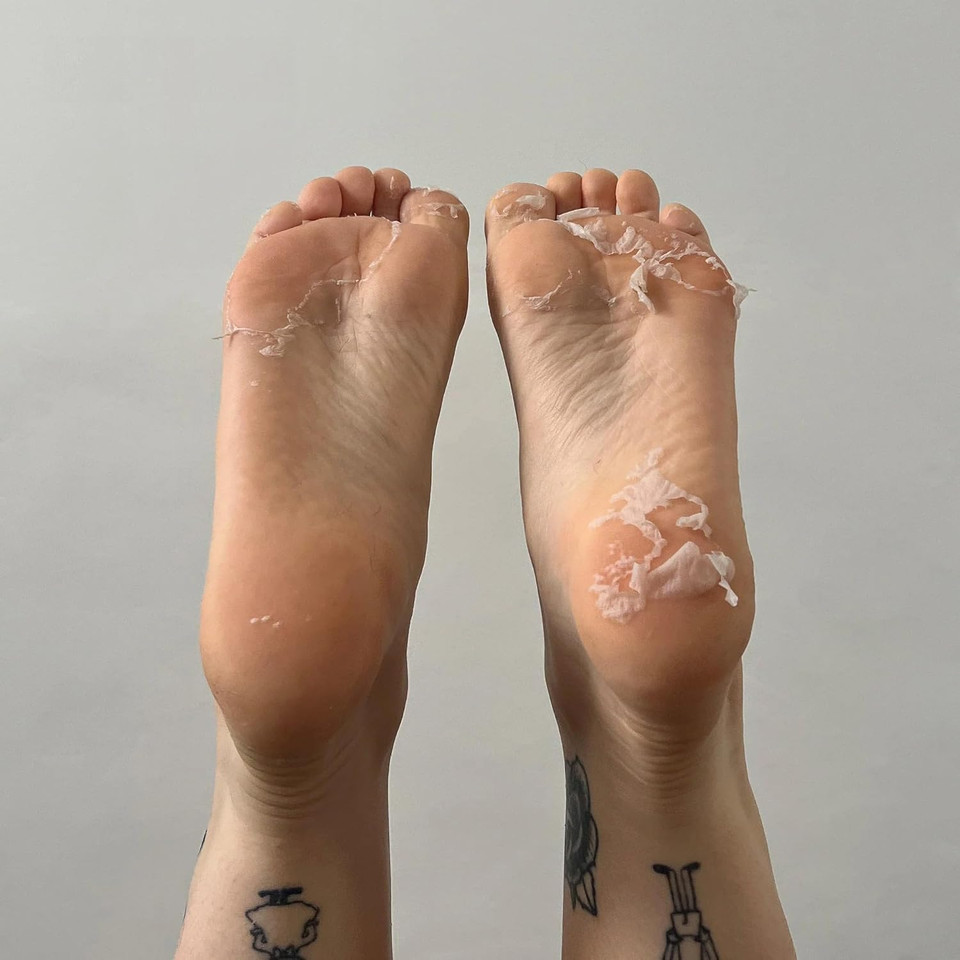 BEAUTYPRO FOOT & CALLUS PEEL Natural Exfoliating Socks Dead Dry Skin Remover Peeling Foot Mask Repair Cracked Heels Vegan For Soft Feet Multi Award Winning Brand
