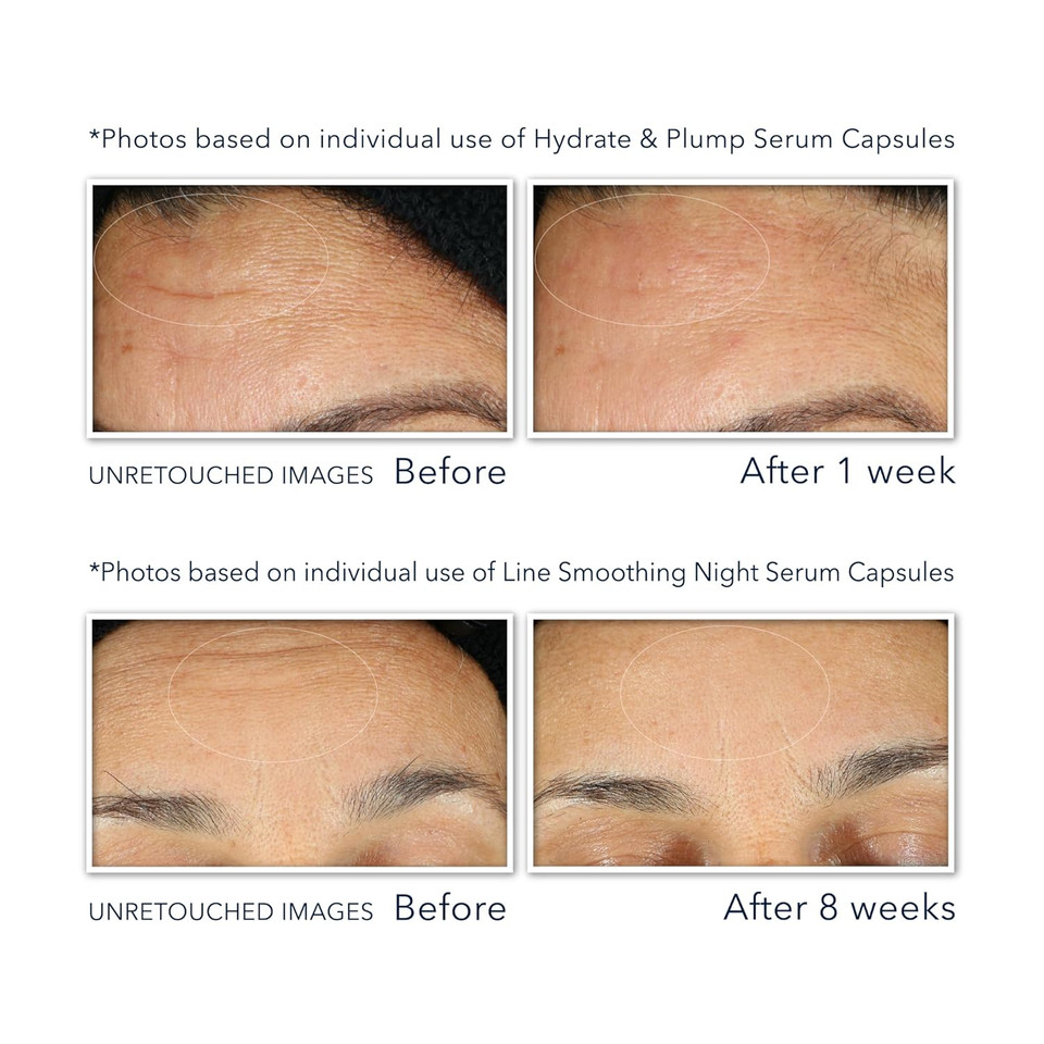 Roc Retinol + Hyaluronic Acid Plumping Power Duo Night Serum Capsules For Visibly Smoother, Tighter Looking Skin, Christmas Gifts & Stocking Stuffers For Women And Men (18Ct Of Each, 36Ct Total)