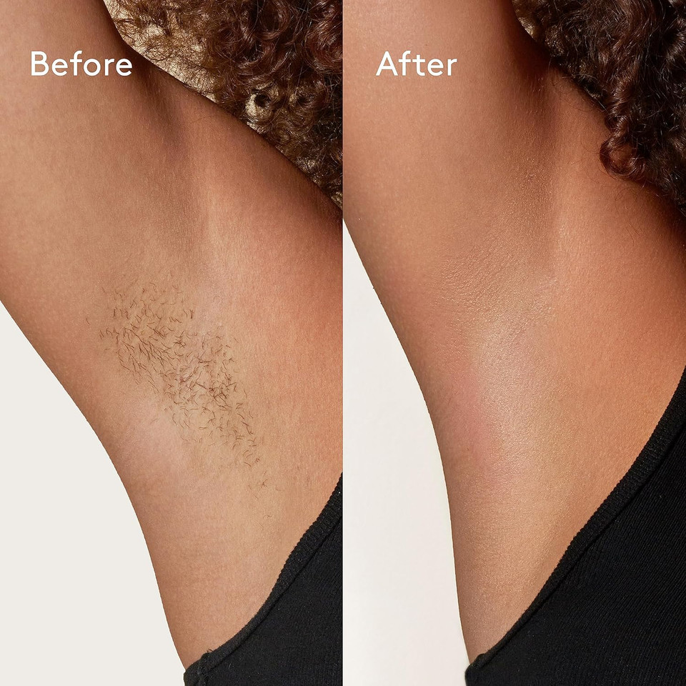 Mylee Rose Soft Creme Wax for Sensitive Skin 450g, Wax Heater Friendly, Ideal for All Body Area Stubborn Coarse Hair Removal