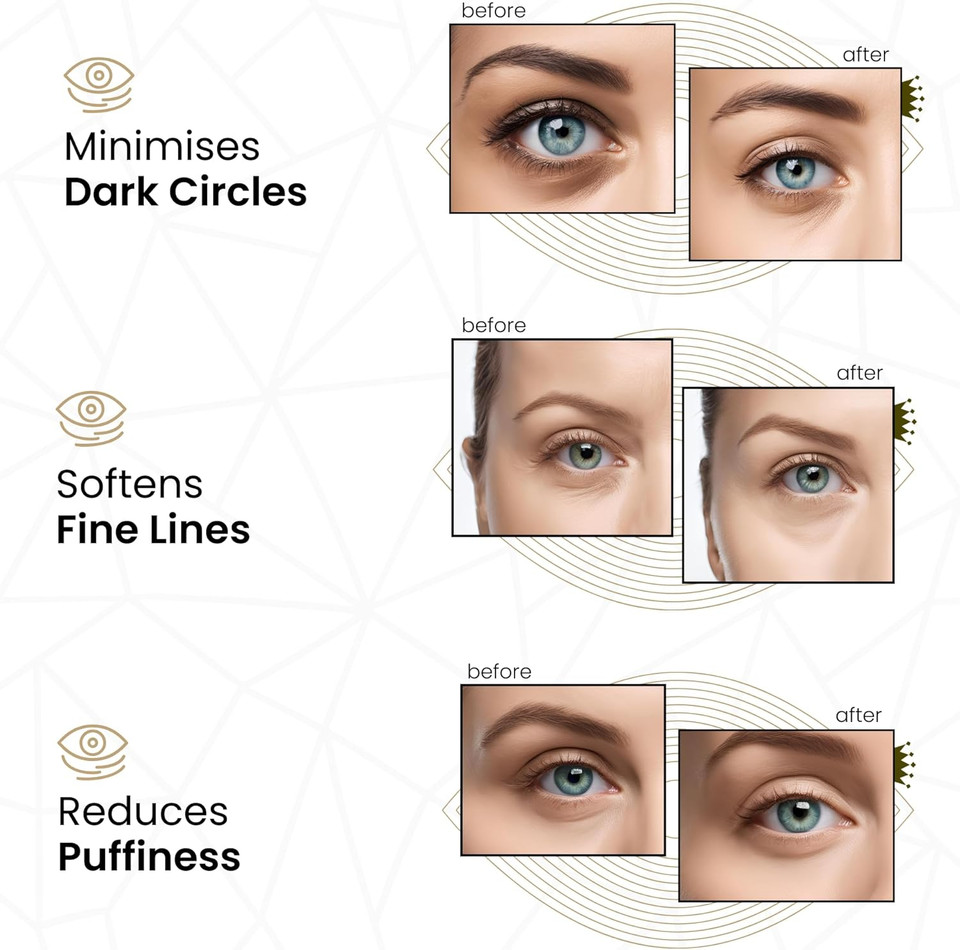 Revitale 24k Gold Under Eye Collagen Patches, Reduce Puffy Eyes & Dark Circles, Illuminate Tired Eye Masks - Firms, Brightens, Energises (Packets - 10 Pair)