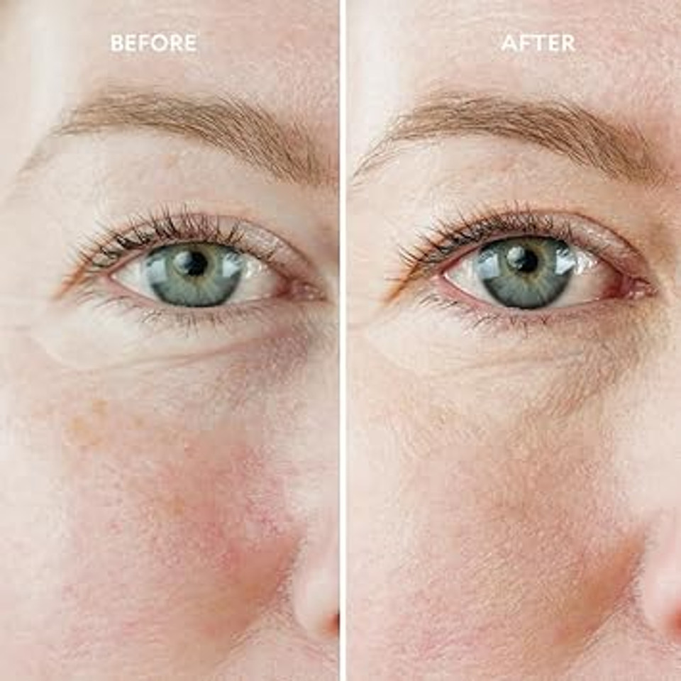 Gatineau - Miracle Eye & Face Contour Cream (30ml), Conceal Dark Circles, Hydrating with Hyaluronic Acid & Vitamin E Gatineau - Miracle Eye & Face Contour Cream (30ml), Conceal Dark Circles, Hydrating with Hyaluronic Acid & Vitamin E