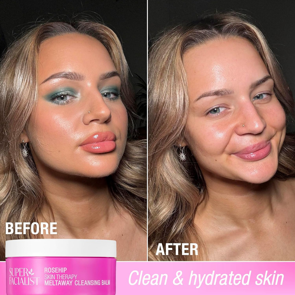 Super Facialist Rosehip Cleansing Balm  Nourishing Makeup Remover Balm & Face Cleanser  Gentle Formula for All Skin Types  Melts Away Impurities 100ml