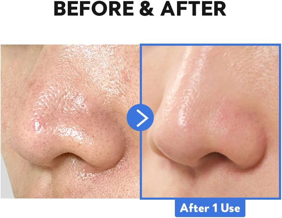 TIRTIR Hydro Boost Enzyme Cleansing Balm (4.05 Ounce (Pack of 1))