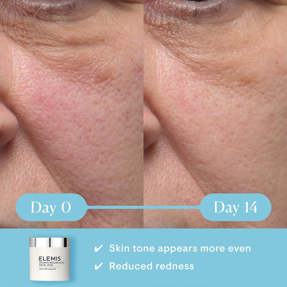 Elemis Dynamic Resurfacing Facial Pads, Exfoliating Face Wipes with Tri-Enzyme Technology, Gentle Exfoliating Rounds for Smooth, 60 Pads