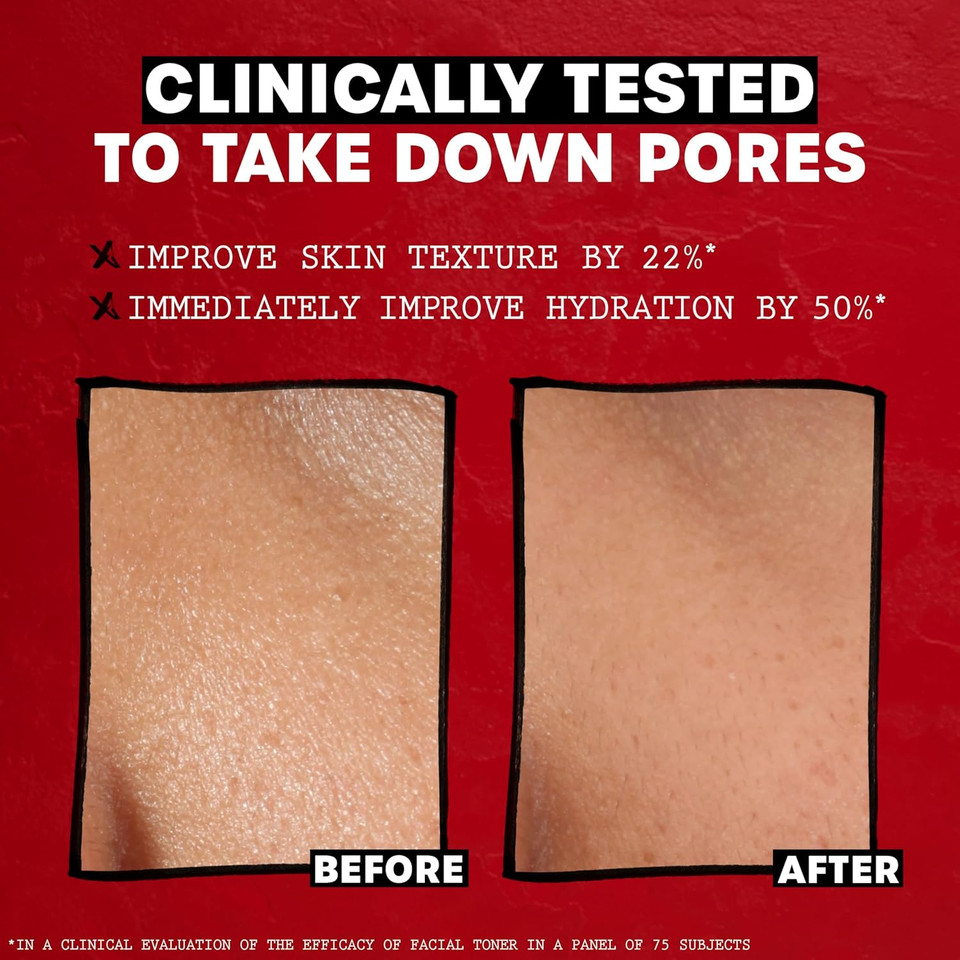 Thayers Witch Hazel Facial Gentle Unscented Toner Lotion with Organic Aloe Vera, 355ml