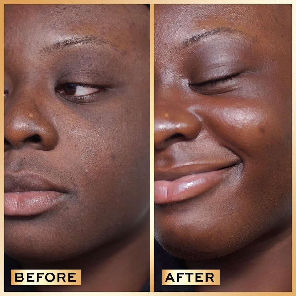 Revolution Pro, Miracle Serum, Hydrating Face Serum, Reduces Dullness, Improves Uneven Skin Tone, Contains Hyaluronic Acid & Niacinamide, 30ml