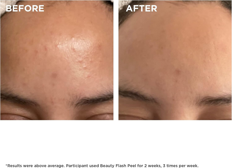 Clarins Beauty Flash Peel 50ml