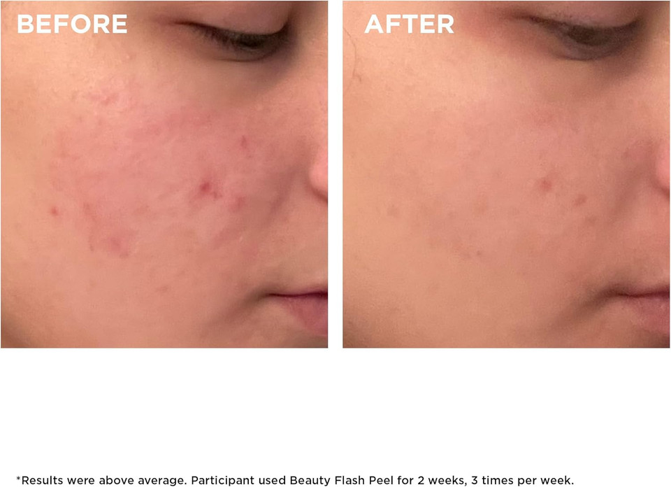 Clarins Beauty Flash Peel 50ml