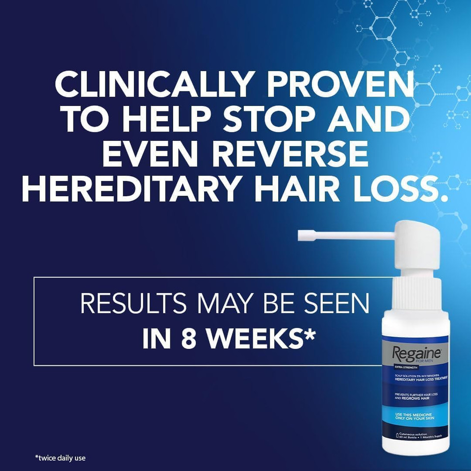 Regaine for Men 5% Minoxidil Extra Strength Scalp Solution for Hair Regrowth (1x 60ml), Scientifically Proven to Help Stop and Reverse Hereditary Hair Loss, Revitalise Hair Follicles