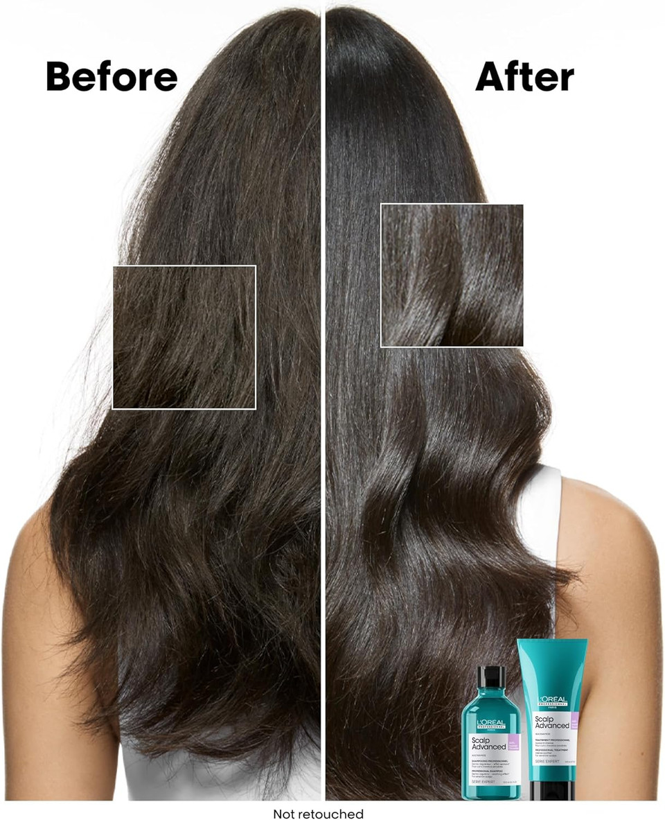 LOréal Professionnel Scalp Advanced Anti-Discomfort Shampoo, For Itchy and Dry Scalps, Deep Scalp Treatment