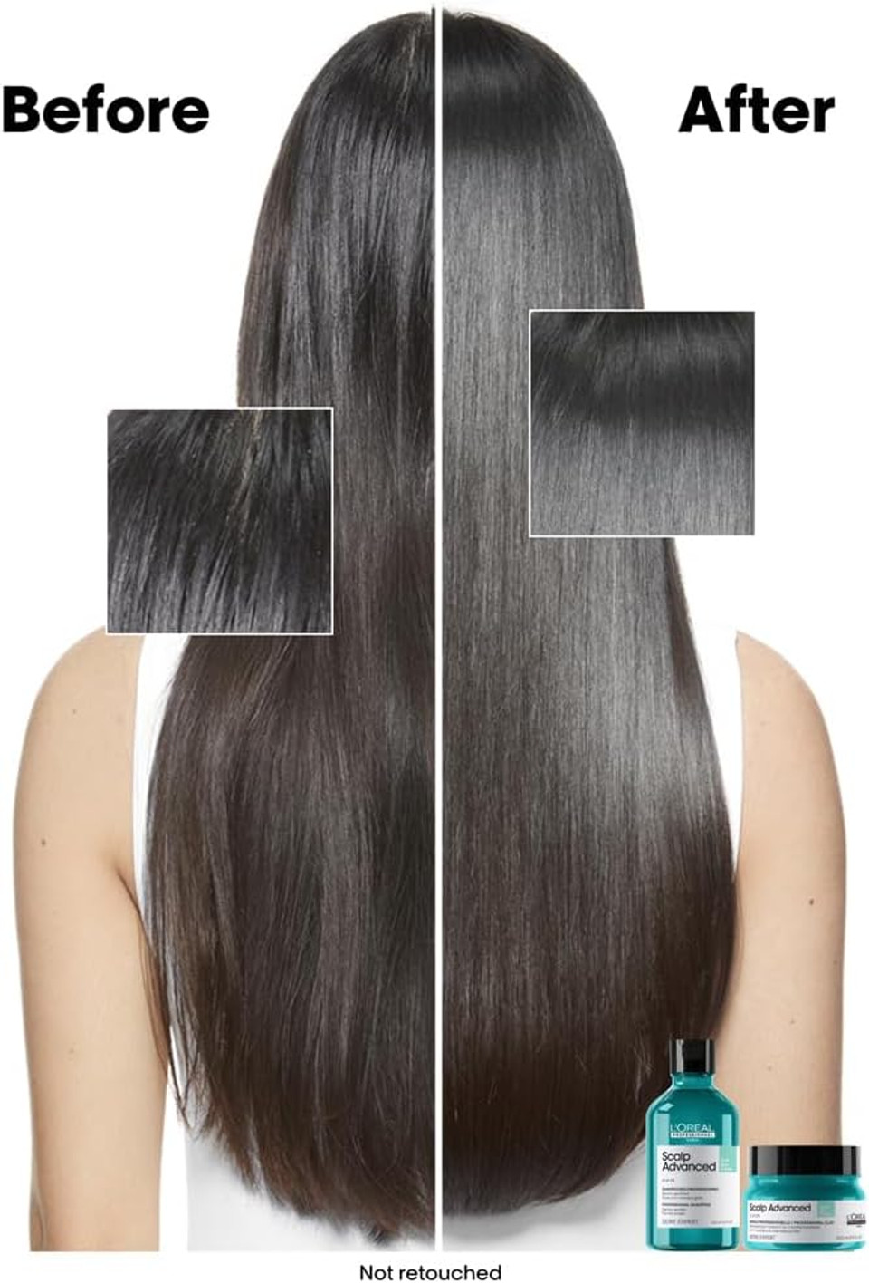 L'Oréal Professionnel Scalp Advanced, Professional Clay Anti-Oiliness 2-in-1 Deep Purifier Shampoo and Hair Mask, For Oily and Greasy Hair, Serie Expert, 250ml