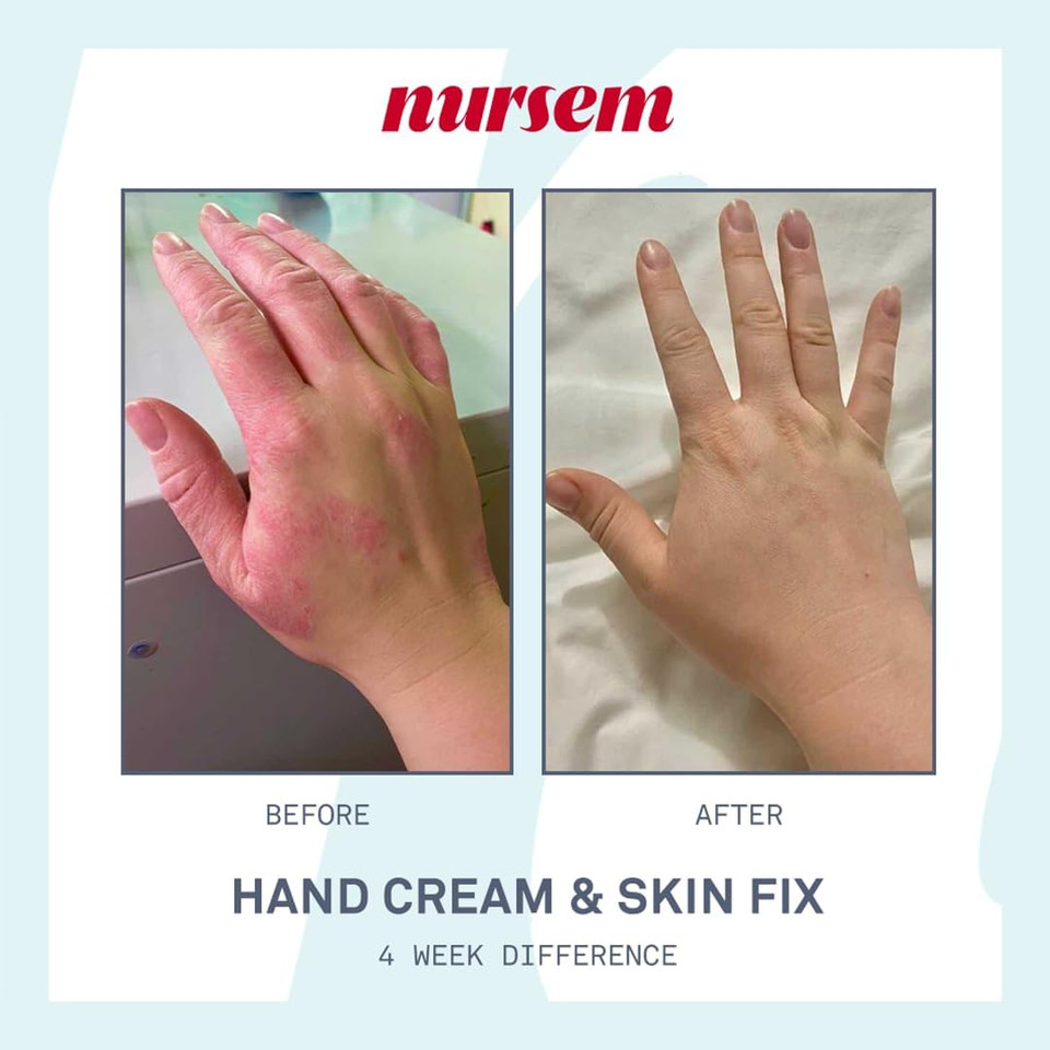 Nursem Caring Hand Cream  300ml | Fast-Absorbing Natural Hand Cream for Very Dry Skin | Fragranced Moisturizer for Deep Hydration, Skin Repair & Protection for Dry, Cracked Hands