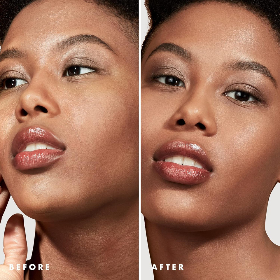 e.l.f. Blemish Control Face Primer, Small, Long Lasting, Skin Perfecting, Controls Breakouts and Blemishes, Matte Finish, Infused with Salicylic Acid, Vitamin E & Tea Tree 14ml e.l.f. Blemish Control Face Primer, Small, Long Lasting, Skin Perfecting, Controls Breakouts and Blemishes, Matte Finish, Infused with Salicylic Acid, Vitamin E & Tea Tree 14ml