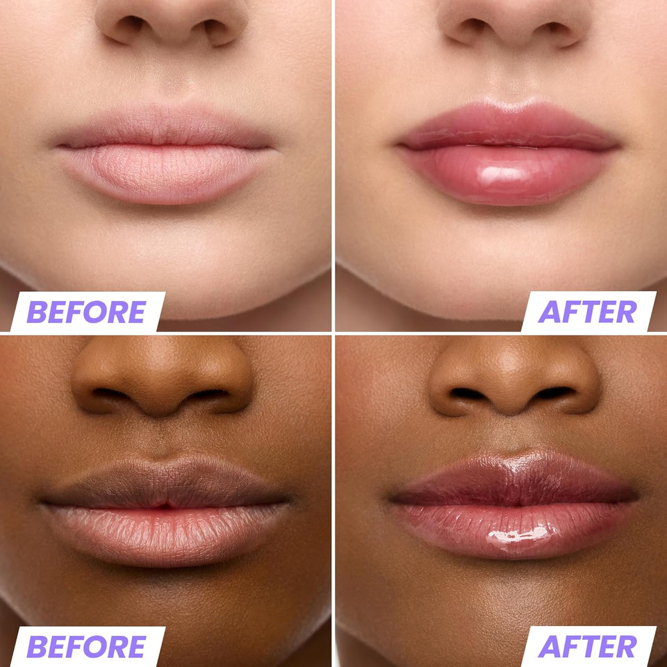 Wonderskin Lip Oil Rehab Serum - Color Changing Lip Oil From Clear To Pink - Ph-Activated, Non-Sticky & Hydrating Tinted Serum For Dry Lips (Kissed)