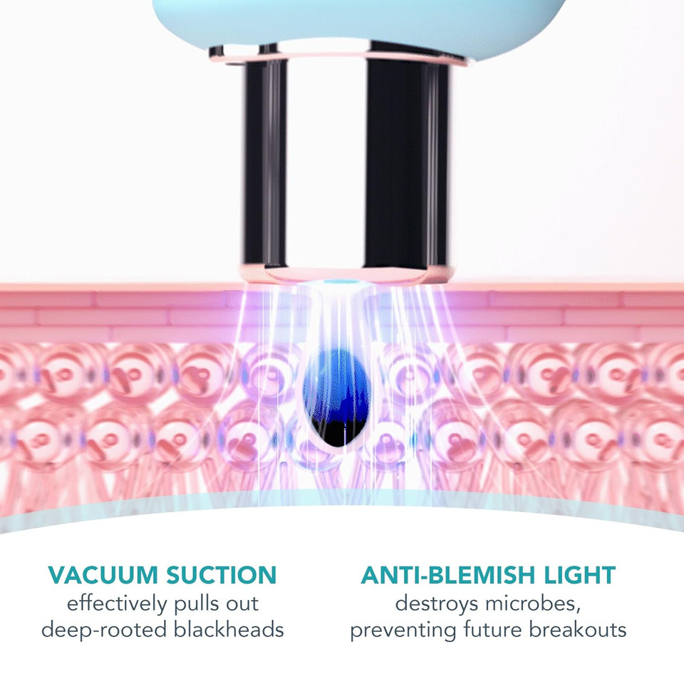 FOREO KIWI Whitehead & Blackhead Remover Tool, Facial Blackhead Remover Vacuum for Face & Nose, Pore Remover & Pimple Popper, Quick & Effective Device with Anti-Blemish Light