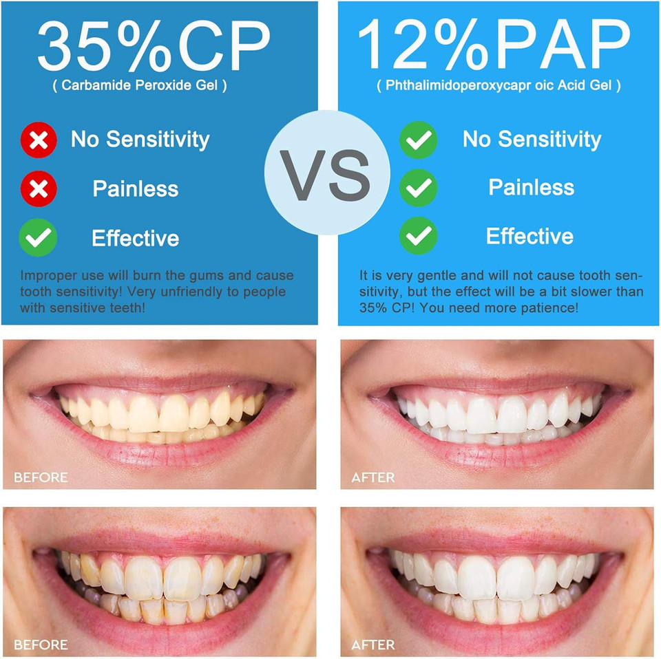 Teeth Whitening Pen, IVISMILE Teeth Whitening Gel Refill(4 Pcs for 40 Uses)12% PAP,Mint Flavoured Teeth Whitener,Safe for Enamel,Non-Sensitive,Effective Teeth Whitening in 60sec for Bright White Teeth