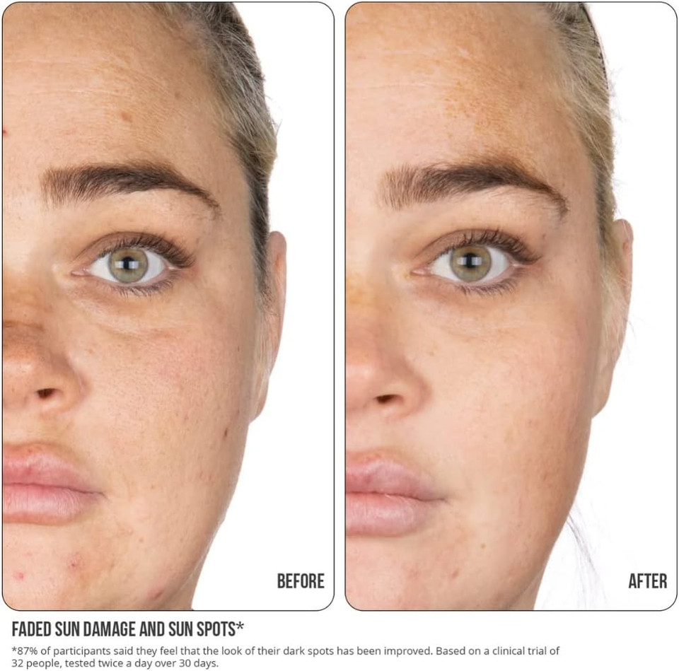 Nip+Fab Vitamin C Fix Concentrate Extreme 30 ml, 15% Vitamin C Complex with 3 Forms of Vitamin C, Face Skin Radiance Booster, with Ferulic Acid and Niacinamide