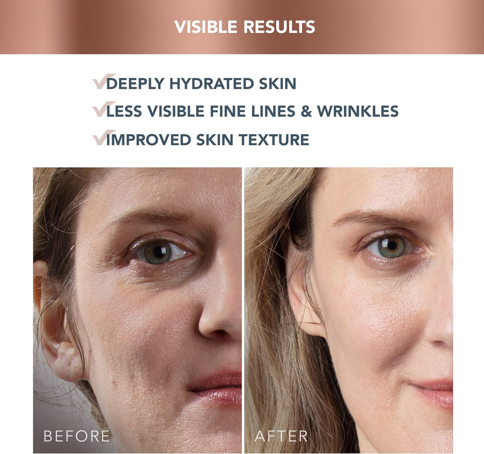 FOREO SUPERCHARGED HA+PGA Triple Action Intense Face Moisturiser - Wrinkle Day Cream for Face - Hyaluronic Acid & Squalane - Vegan - Cruelty & Gluten Free - Clean Skincare - 50ml