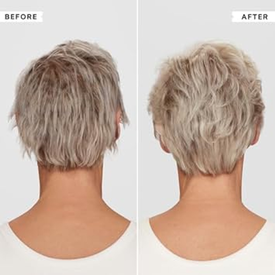 Philip Kingsley | Density Thickening Conditioner | For Thinning Hair and Hair Loss | Fine, Fragile, Thin Hair Thickener and Strengthener | Helps Volumize and Strengthen Hair | 170ml