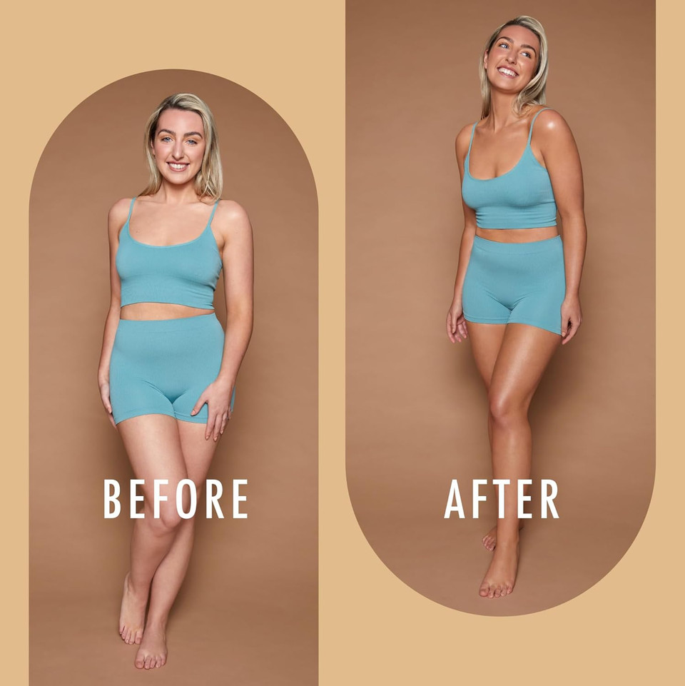 St Moriz Advanced Colour Correcting Tanning Mousse in Medium | With Hyaluronic Acid, Vitamin B5 & Advanced Skin Care Benefits | Neutralises Red Tones | Fast-Drying Vegan Fake Tan Mousse | 200ml St Moriz Advanced Colour Correcting Tanning Mousse in Medium | With Hyaluronic Acid, Vitamin B5 & Advanced Skin Care Benefits | Neutralises Red Tones | Fast-Drying Vegan Fake Tan Mousse | 200ml