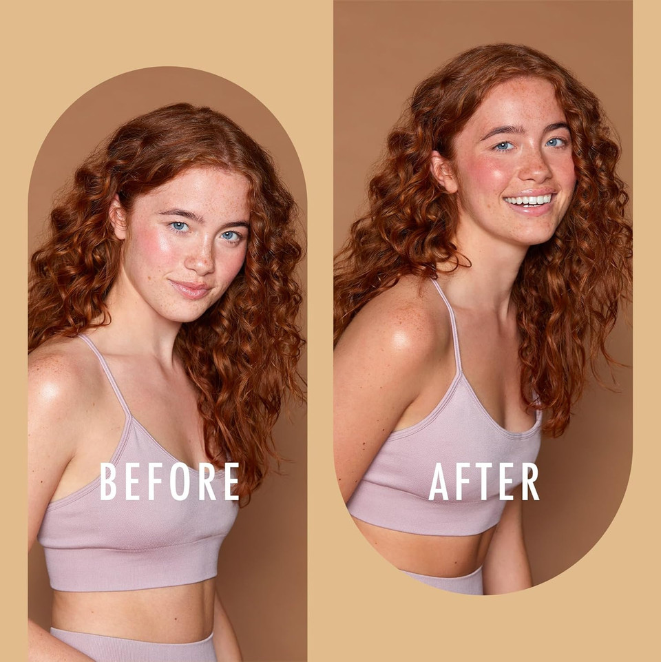 St Moriz Advanced Miracle Glow Face Tan Serum | Hydrating Self Tan Face Serum | With Q10 & Hyaluronic Acid | Natural Buildable Radiant Glow & Gradual Fake Tan | Vegan & Cruelty Free | 30ml