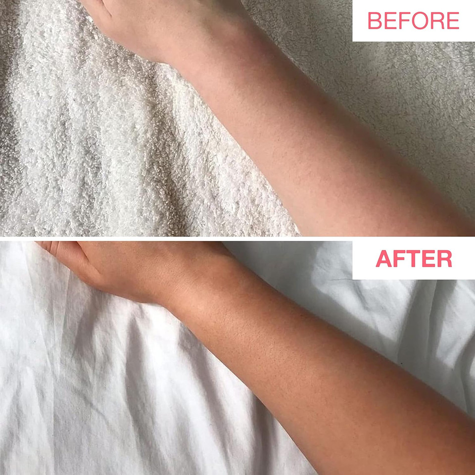 Bare by Vogue - Medium Tan Self-Tanning Lotion - Suitable for All Skin Types - Self Tanner for Face & Body - Long-Lasting Fake Tan - 200ML