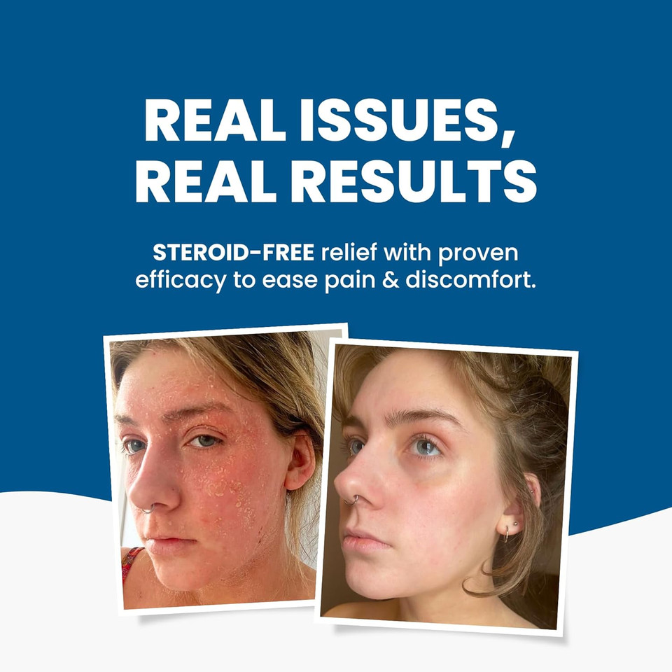 Grahams Natural C+ Eczema Cream - Clinically Proven Eczema Cream for Dry Skin, Inflammation, Dermatitis & Itchy Skin Relief for Adults - with Manuka Honey - Hypoallergenic & Steroid-Free (120g)