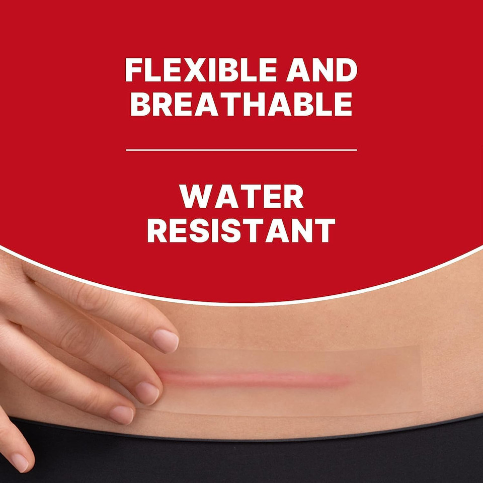 Elastoplast XL Scar Reducer Plasters (21 Pieces), Scar Cover Up Treatment, Strong Adhesion Scar Sheets to Reduce Visibility of Scars, Scar Plaster, Water-Resistant XL Plasters, Clear