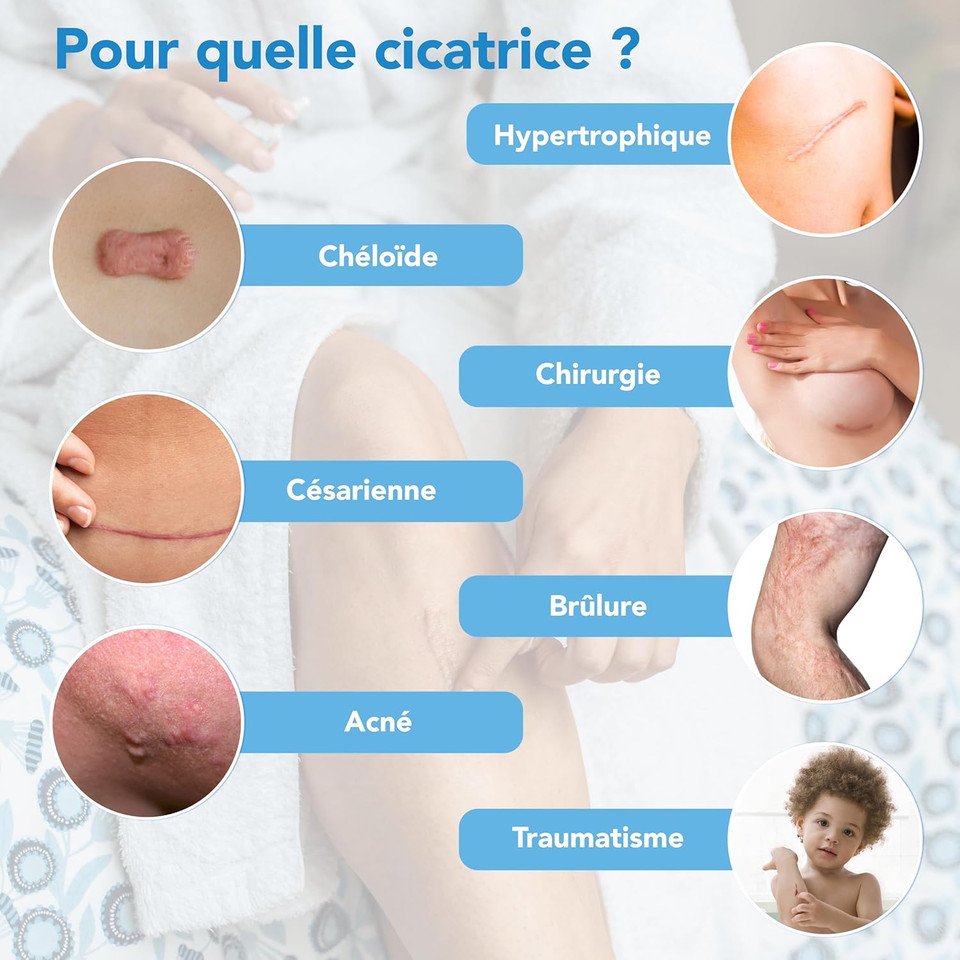 KELO-COTE Advanced Formula Scar Gel Spray, 100ml