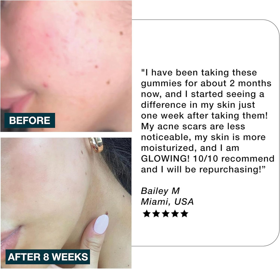 Imarais Glow Skincare Gummies, Vegan, 60 Gummies (Pack of 1)