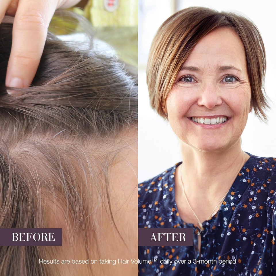 New Nordic Hair Volume Menopause, Supports Healthy Hair Growth, Extra Strength 3000mcg Biotin, Vitamins B6 & B12, Nourishes Mature Hair, 30 Tablets