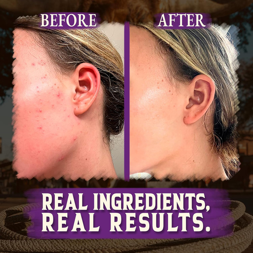 Wrath & Remedy Handmade Whipped Organic Beef Tallow For Skin - 4 Oz (Lavender)  Grass Fed Beef Tallow Moisturizer And Honey Balm For Silky, Sensitive-Skin, Eczema, Rosacea - Free Of Harsh Chemicals