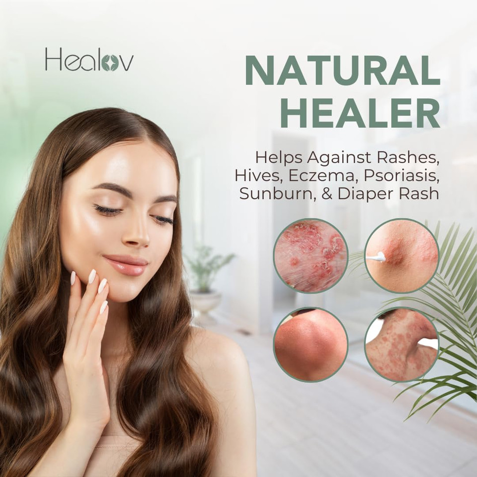 Beef Tallow Balm  All Natural Grass Fed Whipped Tallow All Purpose Balm  Moisturizing, Hydrating Face And Body Lotion For Eczema, Cracked, Dry, Itchy, Irritated Skin  Tallow Body Butter Skincare